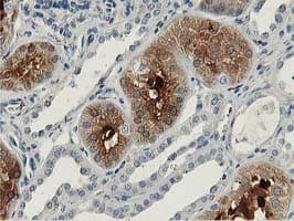 Monoclonal Mouse anti-Human ALDOB Antibody (clone OTI3C6, IHC, WB)