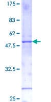 Human IL11 Protein (Recombinant GST)