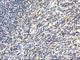 TUBAL3 Antibody (aa150-446, clone OTI1G6, Carrier-free)