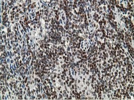DCK / Deoxycytidine kinase Antibody (clone OTI16G6, Carrier-free)