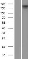 DIAPH3 / MDIA2 Protein (Over-Expression Lysate Myc-DDK (Flag))
