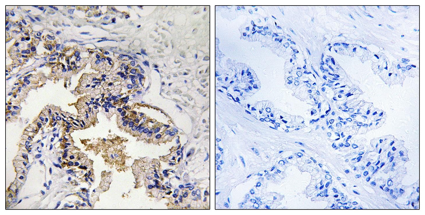 ST6GAL1 / CD75 Antibody