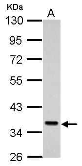 SEC61A1 / SEC61 Antibody (aa413-476)