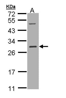 RALB Antibody (aa1-206)