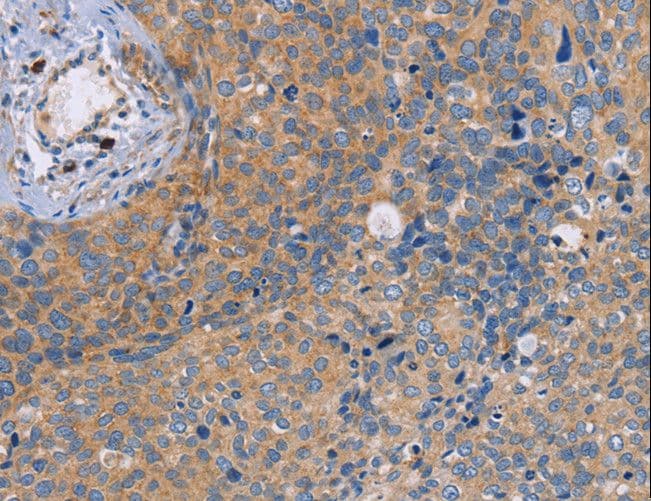 NEK8 Antibody
