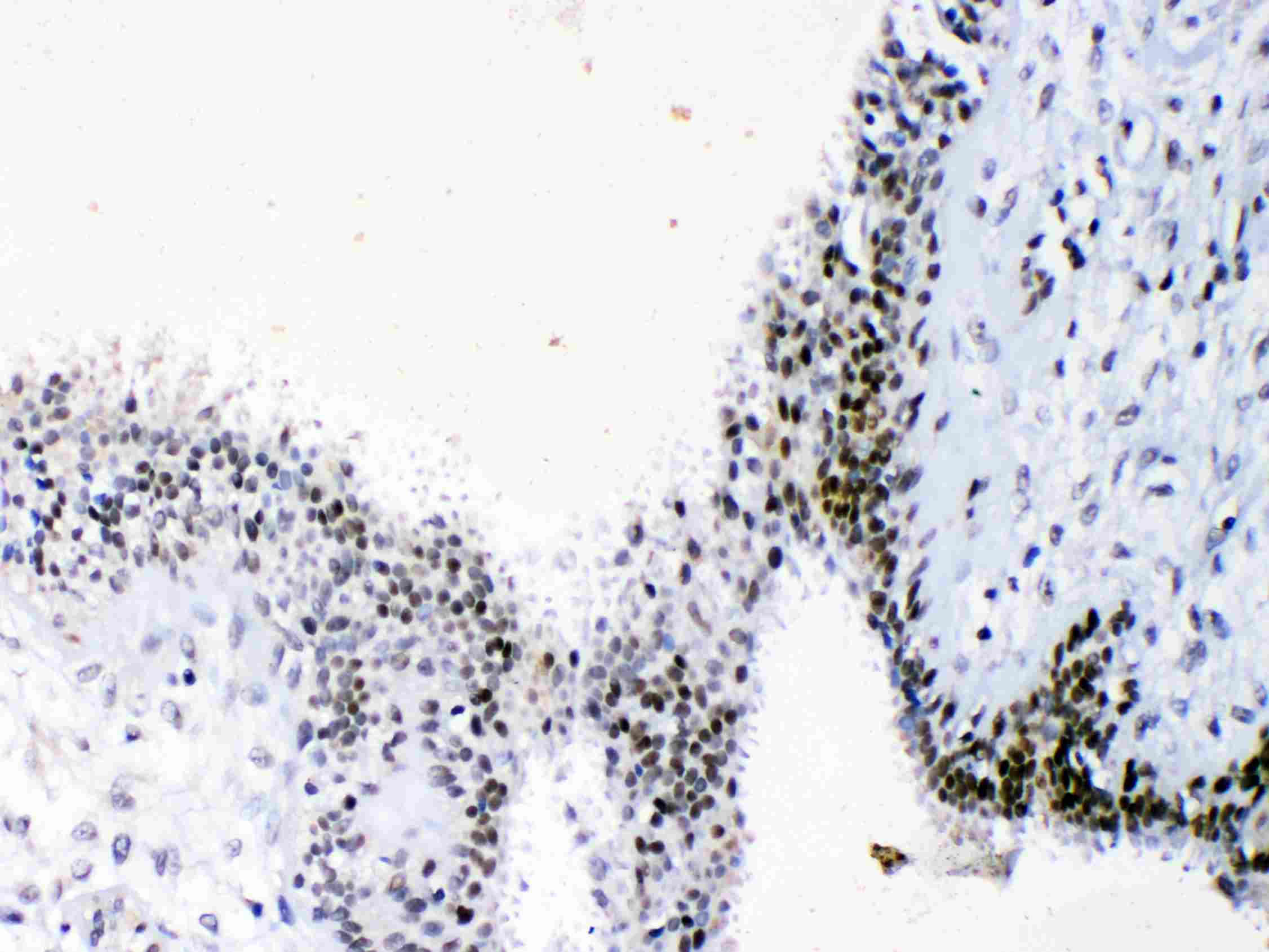 HMG1 / HMGB1 Antibody