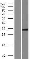 C1QTNF12 Protein (Over-Expression Lysate Myc-DDK (Flag))