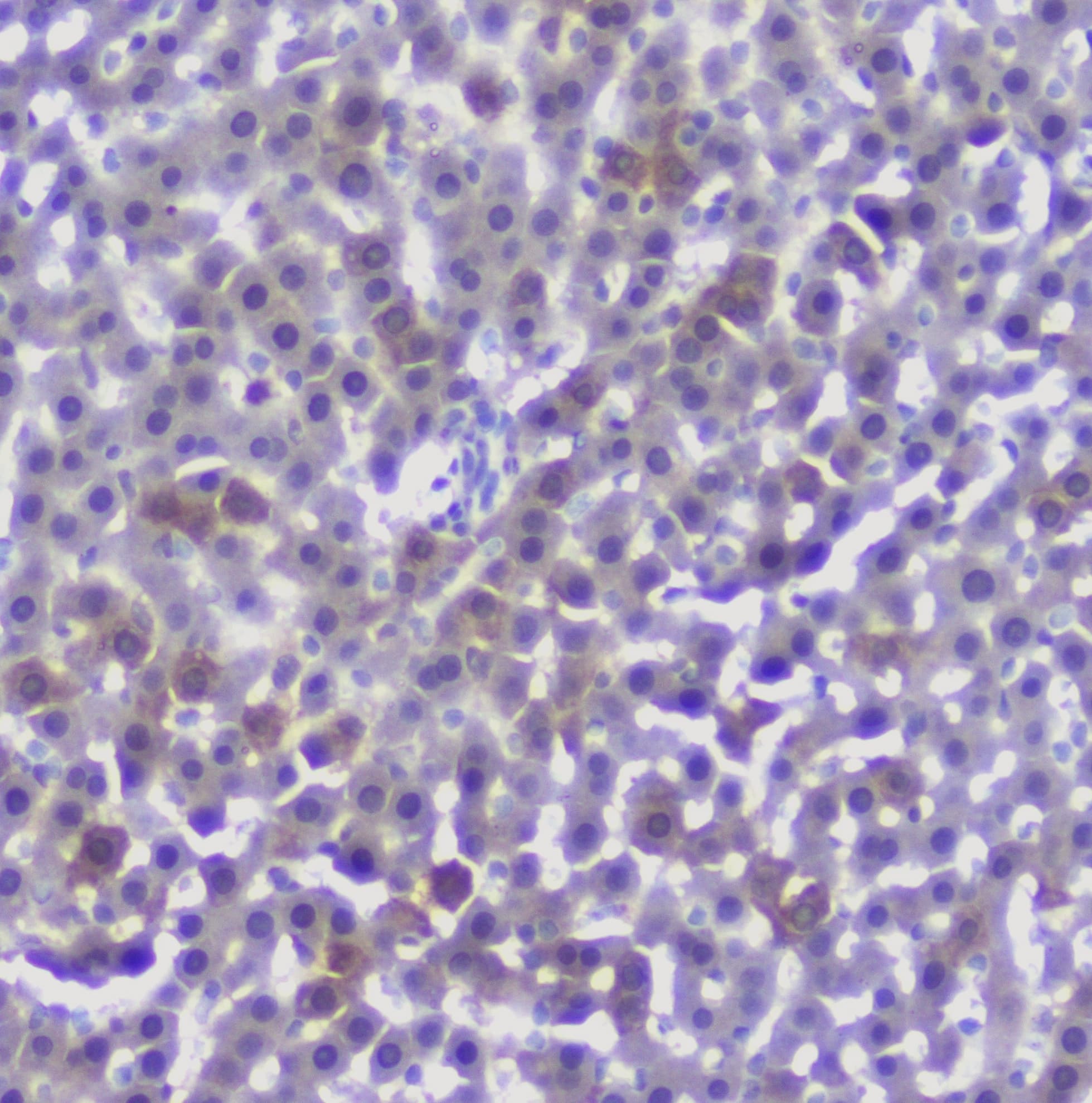 Properdin / CFP Antibody