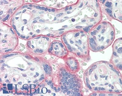 IHC-plus™ VSIR / GI24 / VISTA Antibody (clone 8E11)