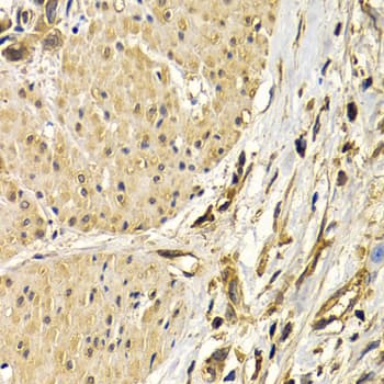 Polyclonal Rabbit anti-Human SNAI2 / SLUG Antibody (IHC, IF, WB)