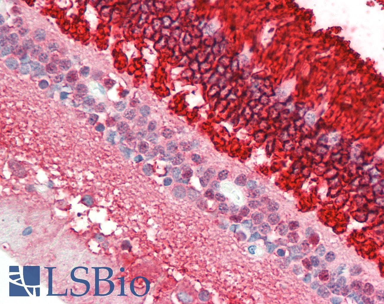 IHC-plus™ Monoclonal Mouse anti-Human Rhodopsin / RHO Antibody (clone A531, IHC, IF, WB)