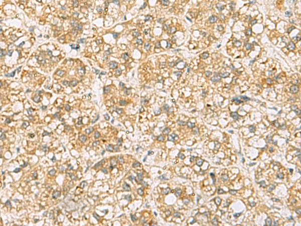 C17orf70 Antibody