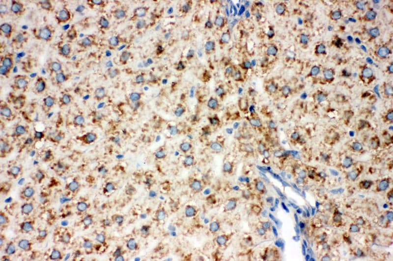 DLD / Diaphorase / E3 Antibody (aa492-509)