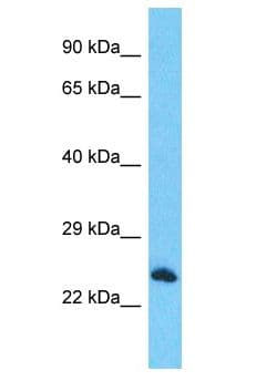 RTFDC1 Antibody (aa72-121)
