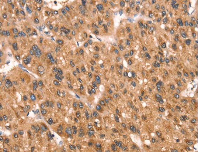 DAP Antibody