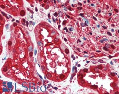 IHC-plus™ PTPMT1 Antibody
