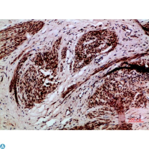 Polyclonal Rabbit anti-Human TMPO / TP / Thymopoietin Antibody (IF, WB)