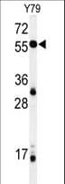 NOB1 / NOB1P Antibody (aa383-412)