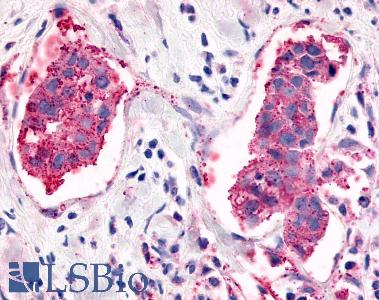 PathPlus™ Polyclonal Rabbit anti-Human ADGRL4 / ELTD1 Antibody (C-Terminus, IHC)