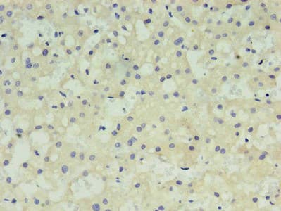 Monoclonal Mouse anti-Human Alpha-Fetoprotein Antibody (clone 4G2D2, IHC)