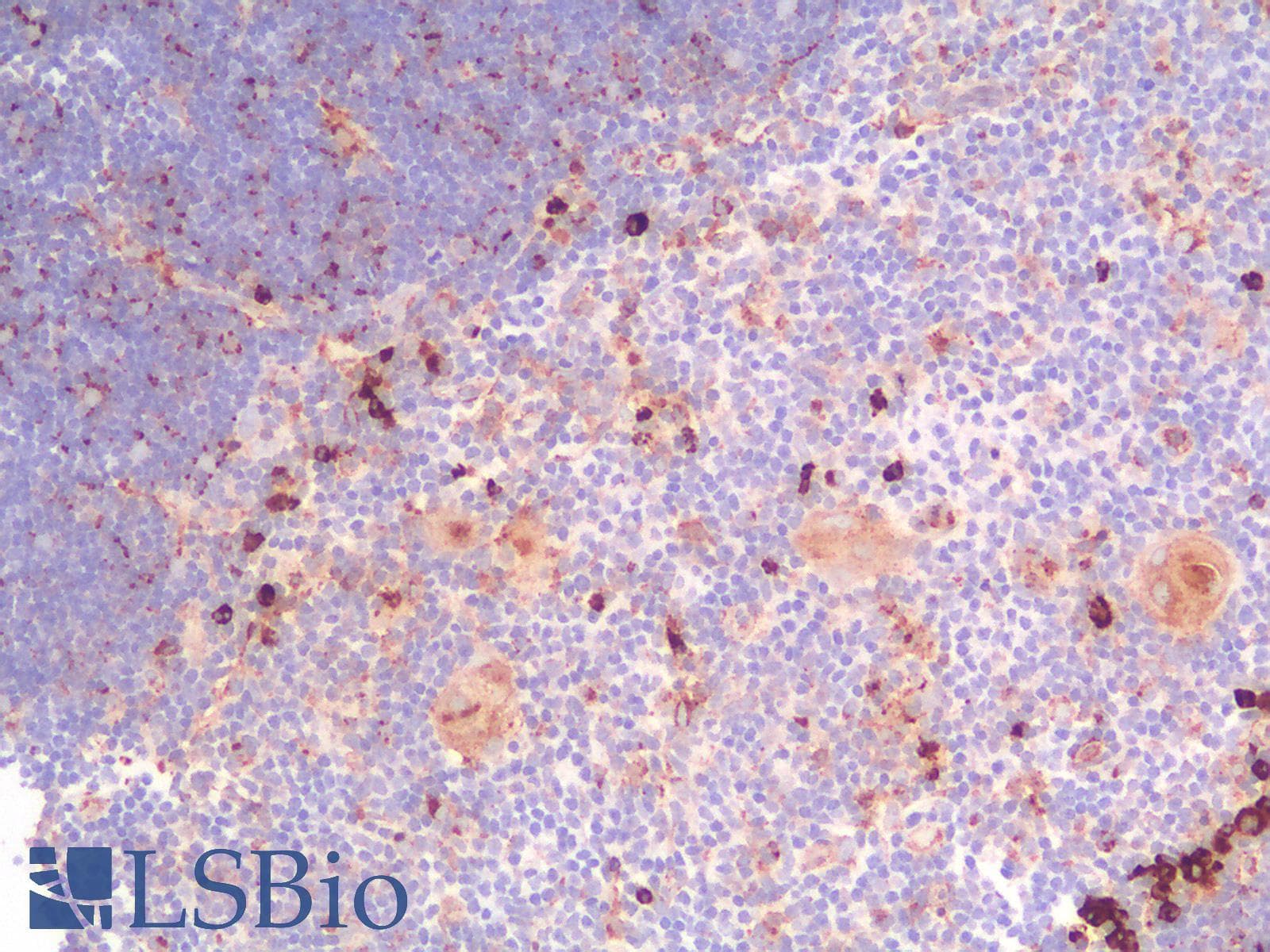 PathPlus™ CD63 Antibody (clone rMX-49.129.5)