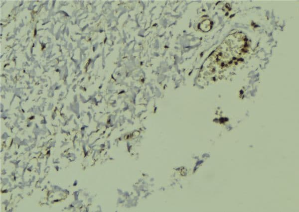 NR1H2 / LXR Beta Antibody