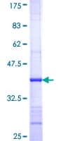 Human ADCY3 / Adenylate Cyclase 3 Protein (Recombinant GST, N-terminus)