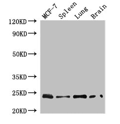 RAB25 Antibody