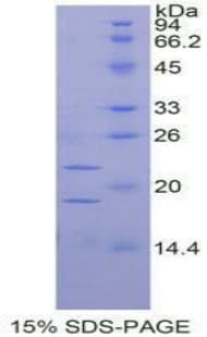 Rat PGF / PLGF Protein (Recombinant His-T7)