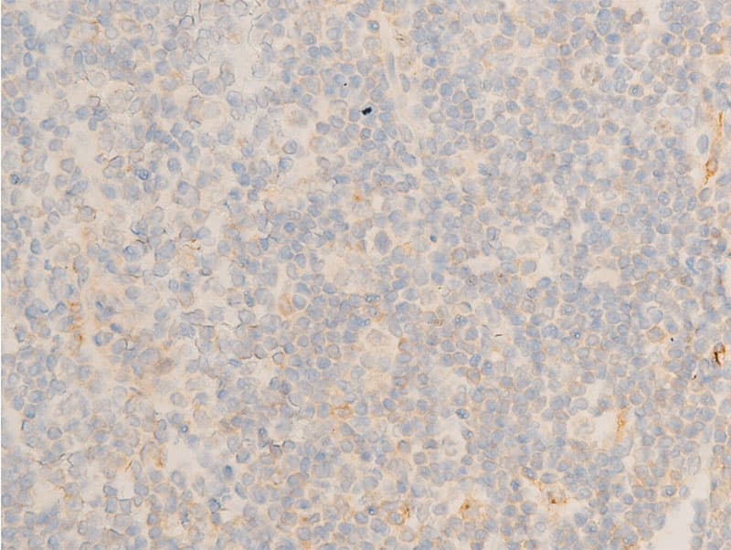 Polyclonal Rabbit anti-Human NFKBIE / IKB Epsilon Antibody (phospho-Ser22, IHC, IF, WB)
