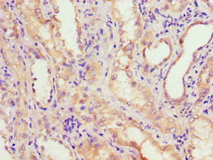Polyclonal Rabbit anti-Human ADH4 Antibody (aa1-380, IHC, WB)