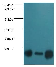 IHC-plus™ Polyclonal Rabbit anti-Human TOMM20 Antibody (aa20-145, IHC, IF, WB)