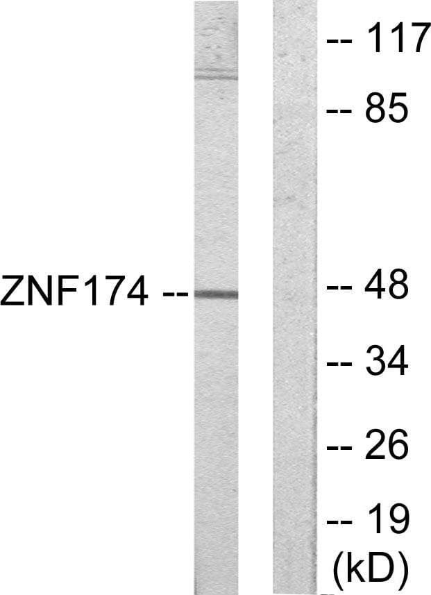 ZNF174 Antibody