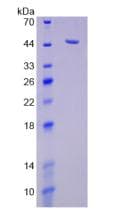 Human NEU1 / NEU Protein (Recombinant His, N-Terminal)