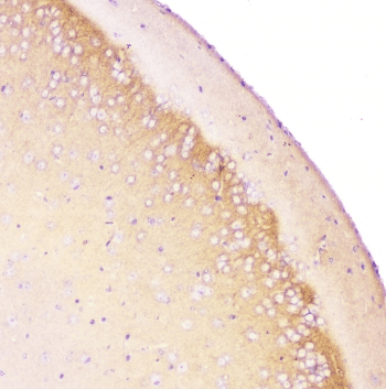 Beta Amyloid Antibody (aa672-702)