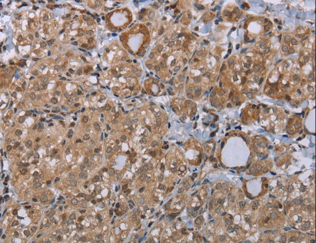 LIMK1 / LIMK Antibody