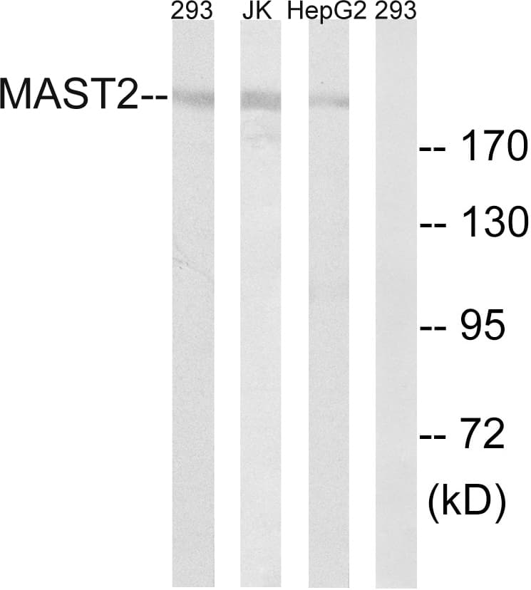 MAST205 / MAST2 Antibody (aa1201-1250)