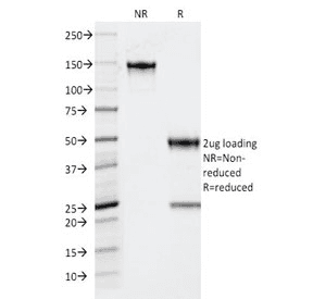 TPO / Thyroid Peroxidase Antibody (clone TPO/1922)