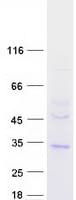 Human TMEM38B Protein (Recombinant Myc-DDK (Flag))