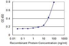 ACP5 / TRAP Antibody (clone 2D9)