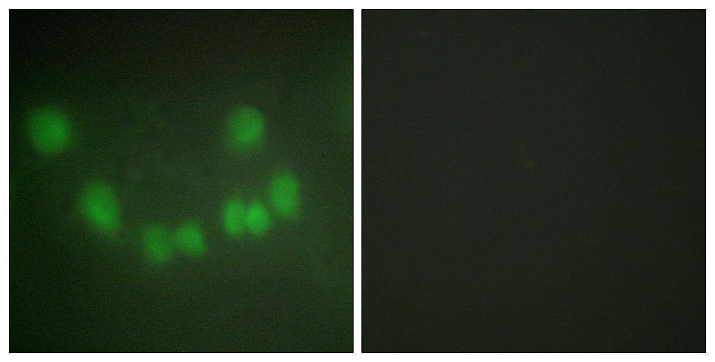 CDK1 / CDC2 Antibody