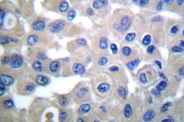 Polyclonal Rabbit anti-Human TGM2 / Transglutaminase 2 Antibody (Asp11, IHC, WB)