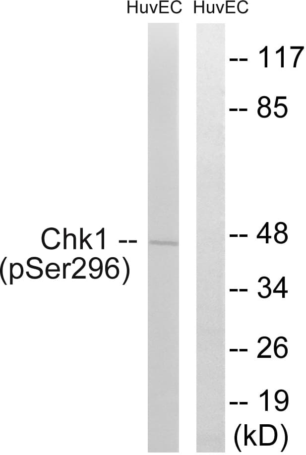 CHEK1 / CHK1 Antibody (phospho-Ser296)