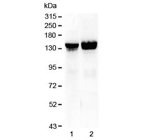 Polyclonal Rabbit anti-Mouse COL2A1 / Collagen II Alpha 1 Antibody (WB)