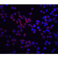 RICK / RIP2 Antibody