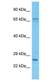 Polyclonal Rabbit anti-Human SPDYE2L Antibody (aa184-233, WB)