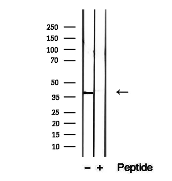 IVD Antibody