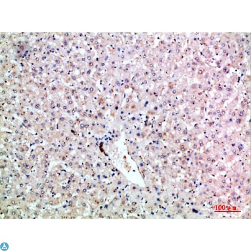 Lymphotoxin-Beta / LTB Antibody