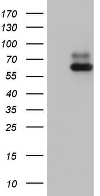 RORA / ROR Alpha Antibody (aa98-345, clone OTI2C4)