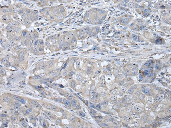 RASA1 Antibody